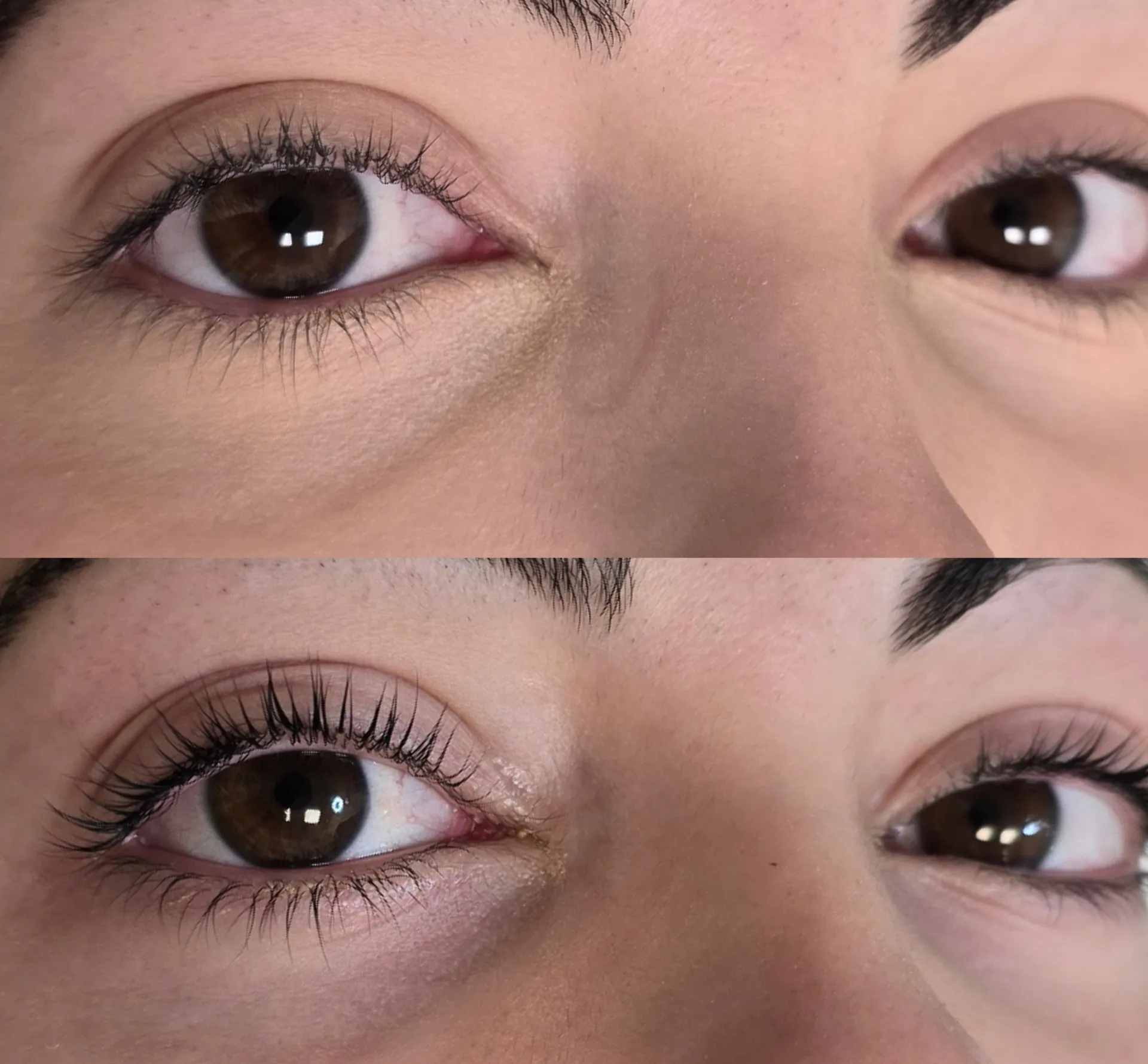 Lash Lifting — Antes / Depois