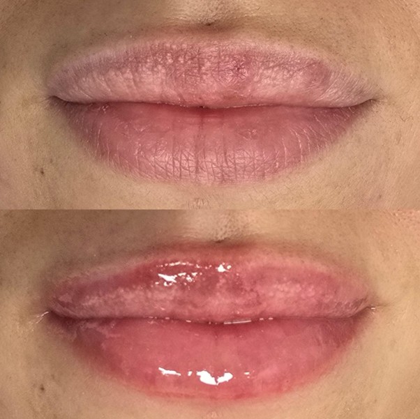 Hydra Gloss — Antes / Depois