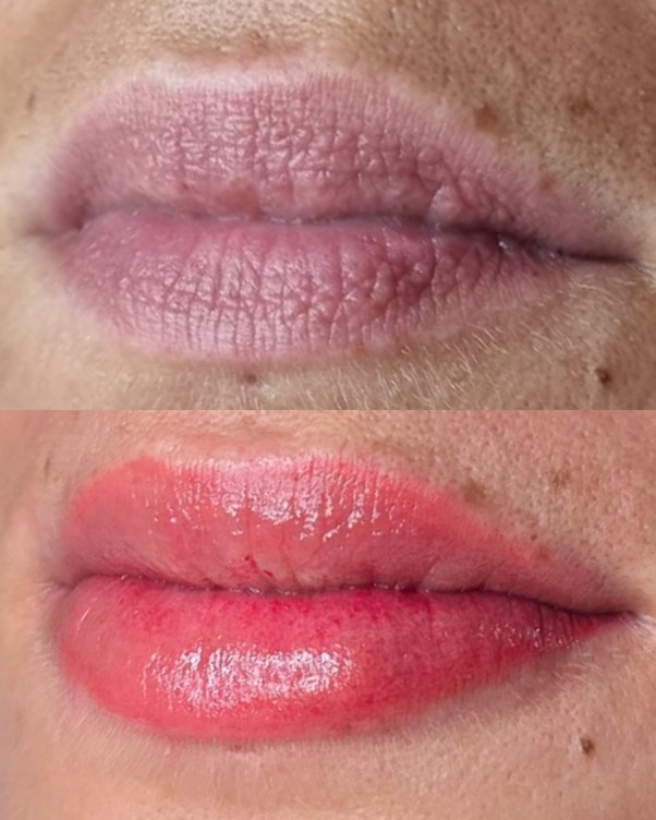 Micropigmentação Labial — Antes / Depois