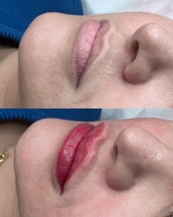 Micropigmentação Labial — Antes / Depois