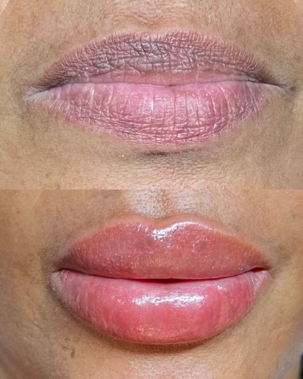 Micropigmentação Labial — Antes / Depois